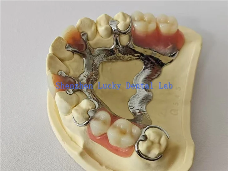 Estrutura de metal em forma de ferradura com laboratório odontológico de dentadura de acrílico